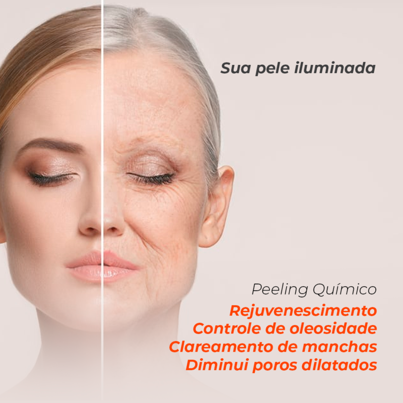 Rejumax | 1 uni 5 Prancheta 5