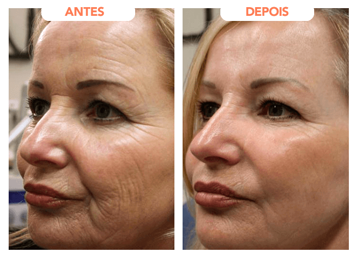 ROSA AMAZÔNICA SERUM 4 resultado 01 340782ea 1920w 1 1