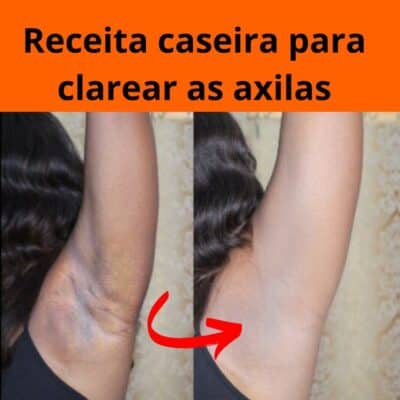 creme clareador para melasma IMG 20230216 143225 620 1
