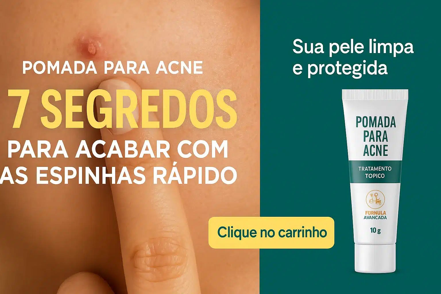 Pet Blog 2 anuncio acne horizontal