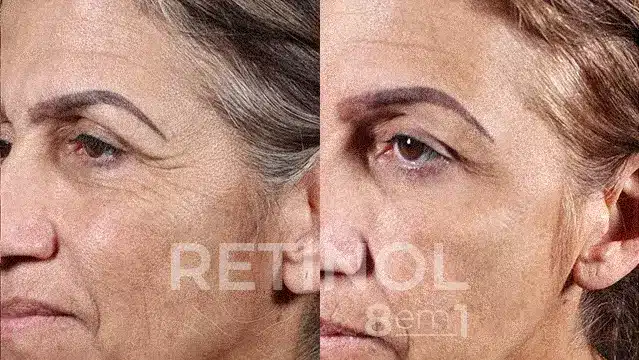 RETINOL 8 EM 1 17 AnyConv.com 44 1