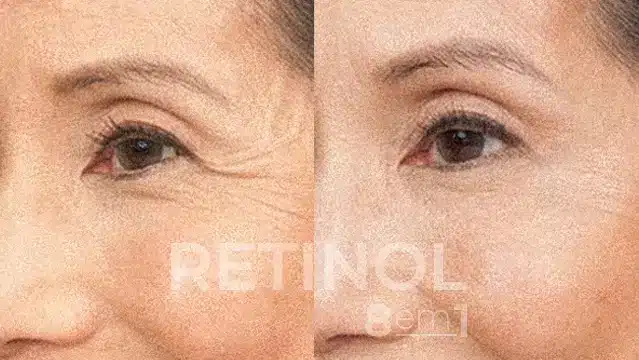 RETINOL 8 EM 1 19 AnyConv.com 77 1