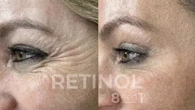 RETINOL 8 EM 1 21 AnyConv.com 88 1