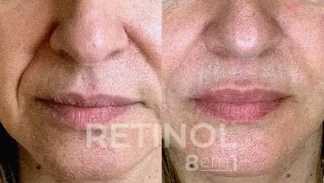 RETINOL 8 EM 1 23 AnyConv.com 99 1