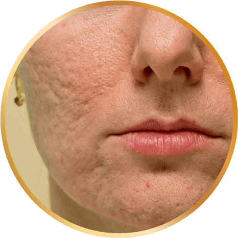 RETINOL 8 EM 1 8 cicatriz 1