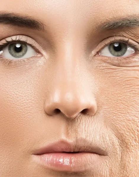 aging