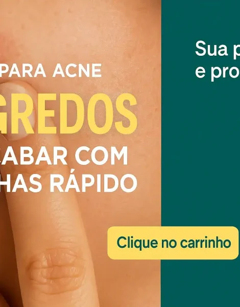 anuncio_acne_horizontal